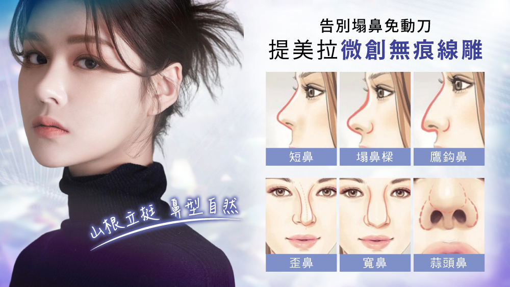 晶鑽診所 埋線鼻雕推薦