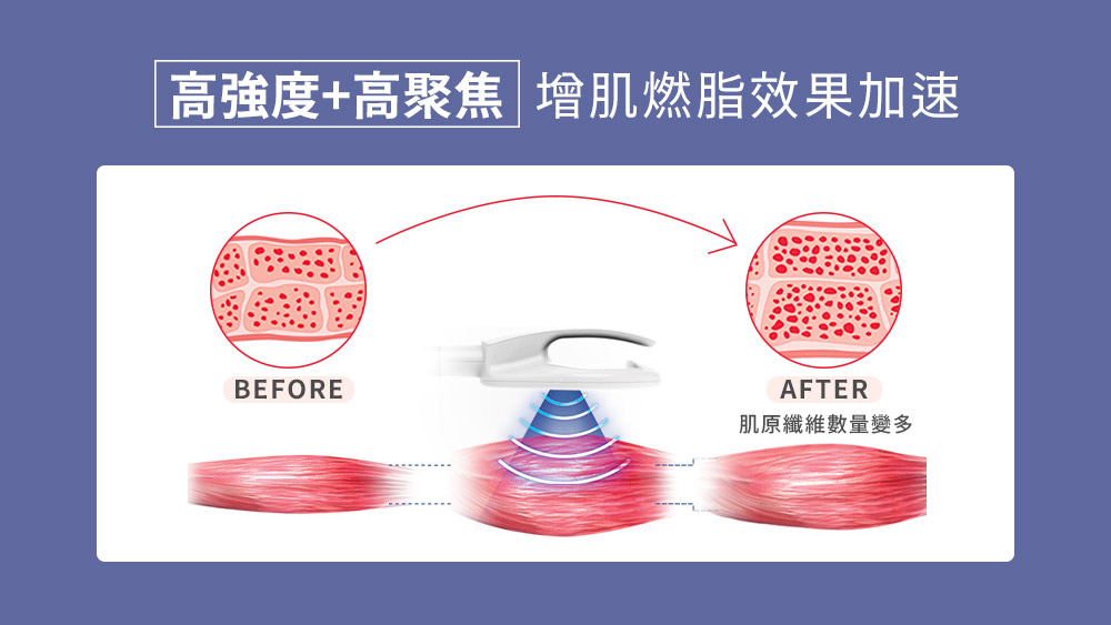 晶鑽診所_CMslim增肌減脂的原理?