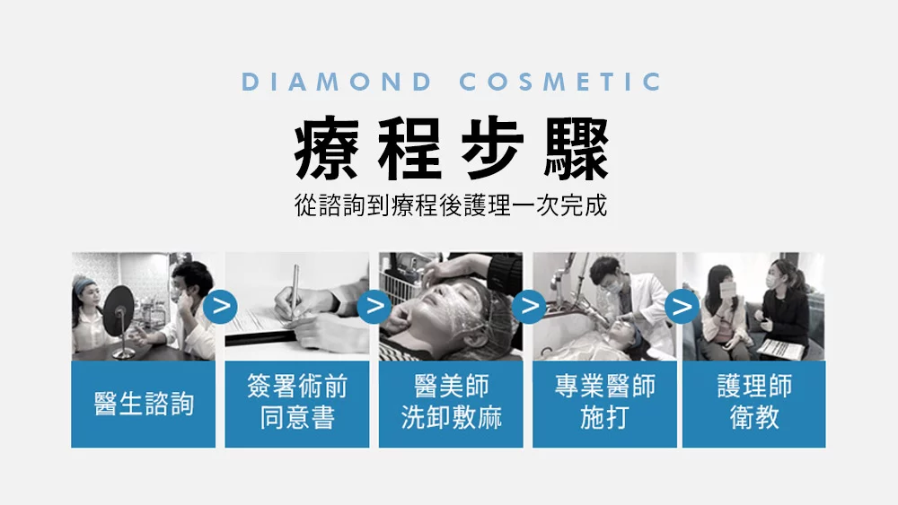 晶鑽診所_索夫波療程步驟