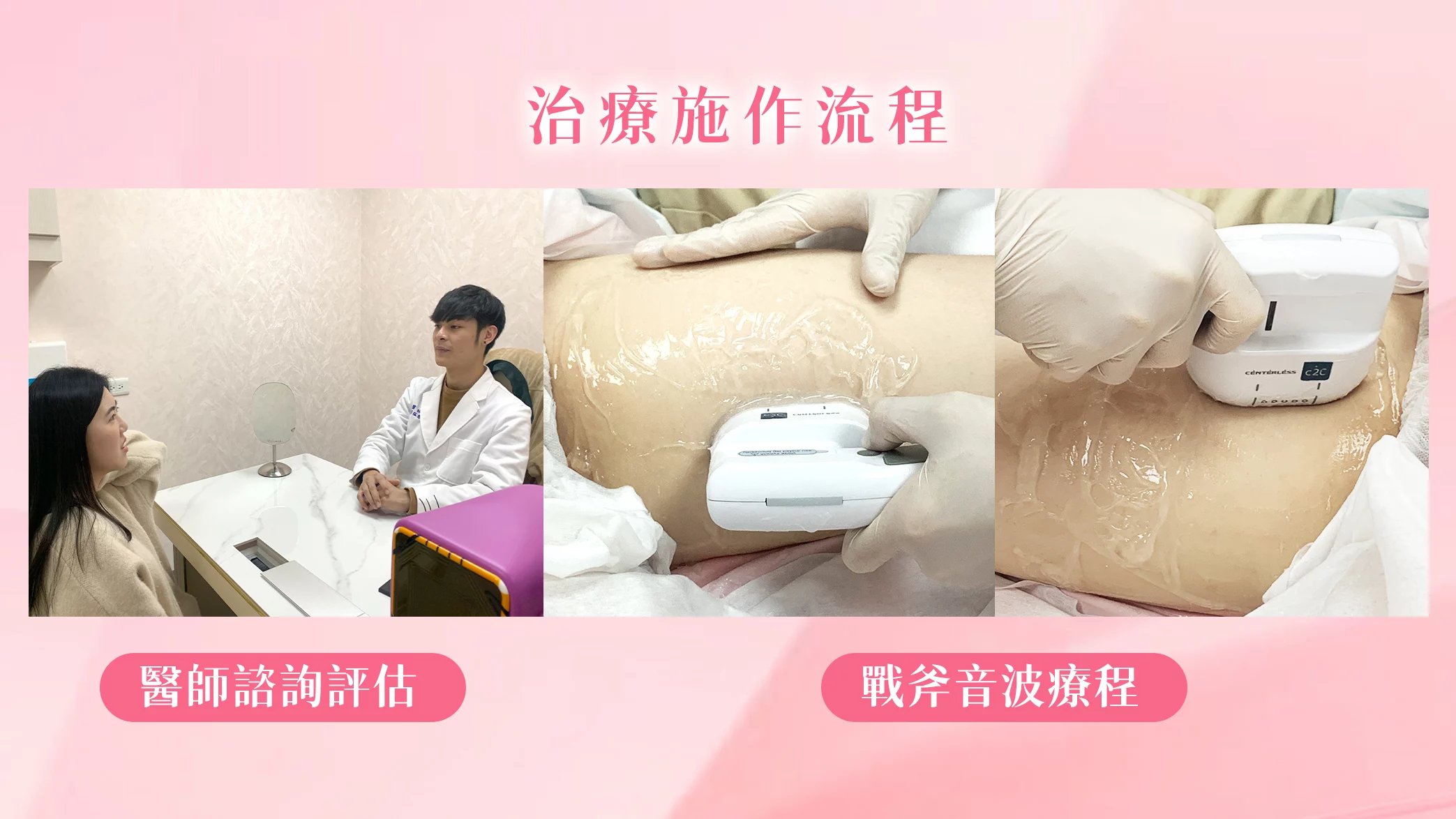 晶鑽診所 戰斧音波 醫師諮詢　施作過程