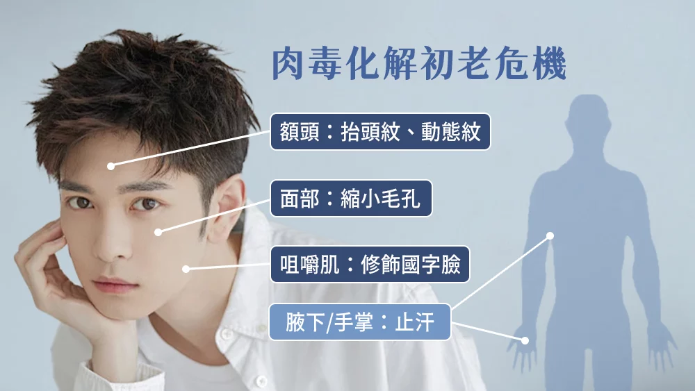 晶鑽診所 肉毒化解初老危機