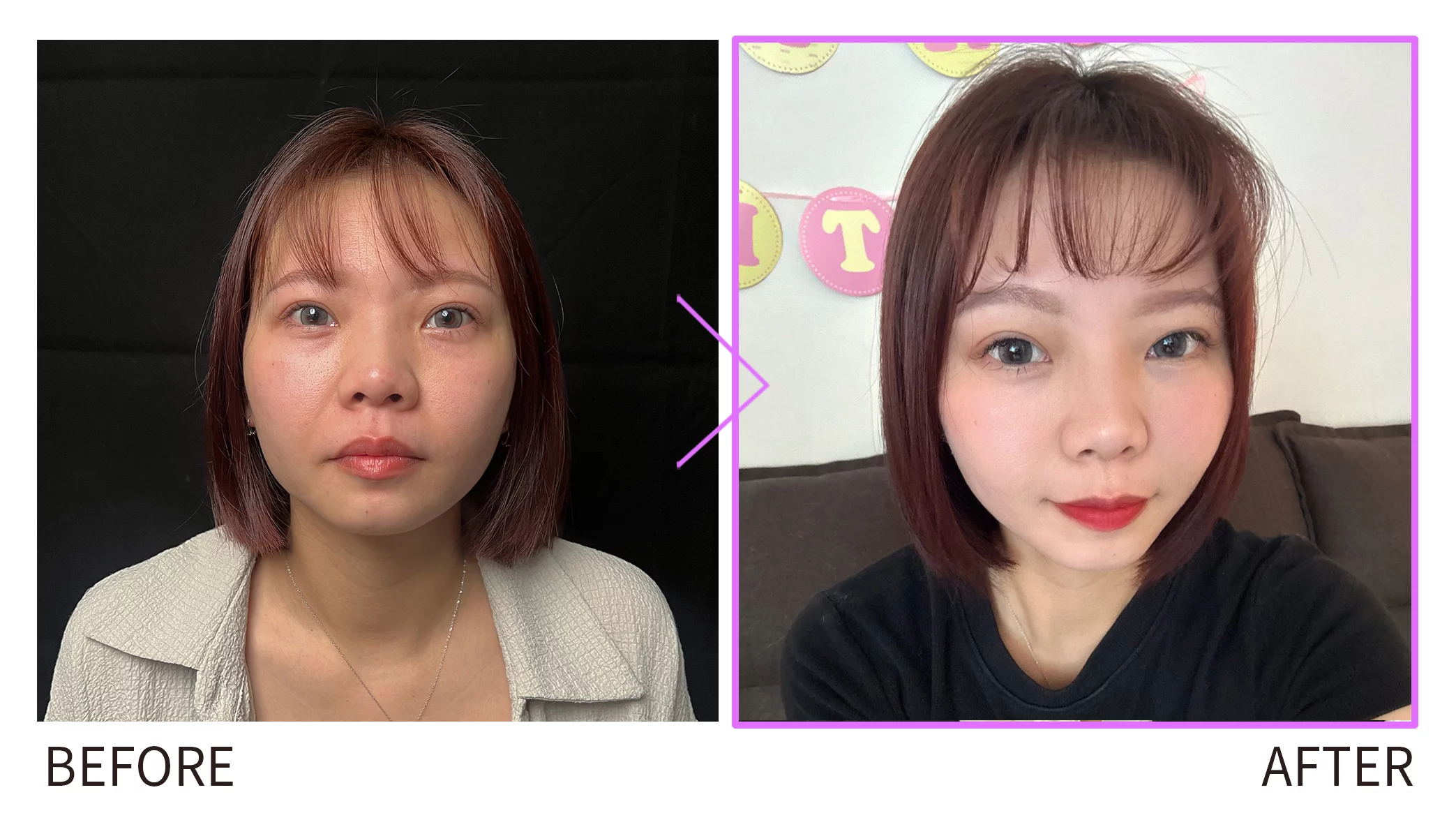 妮芙蕾BA圖美圖1 0