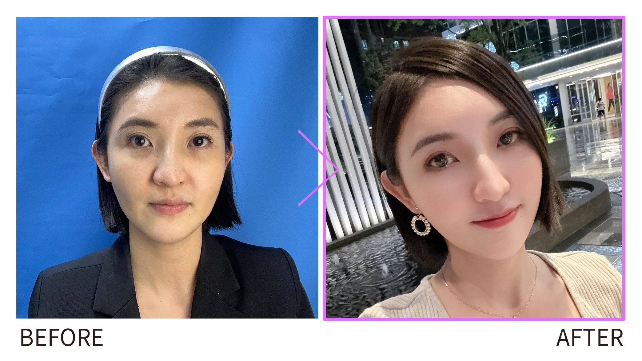 妮芙蕾BA圖美圖2 0