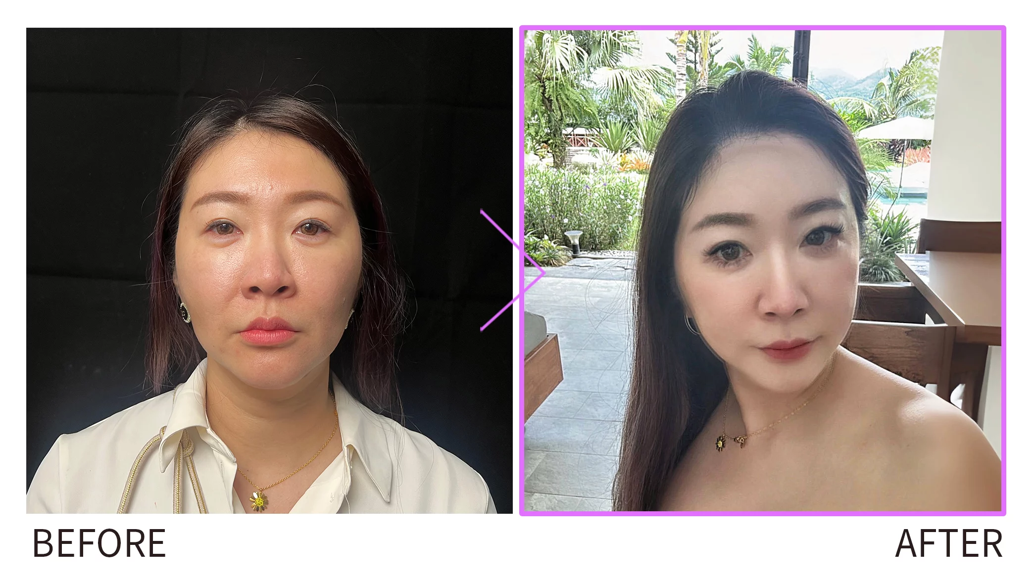 妮芙蕾BA圖美圖3 0