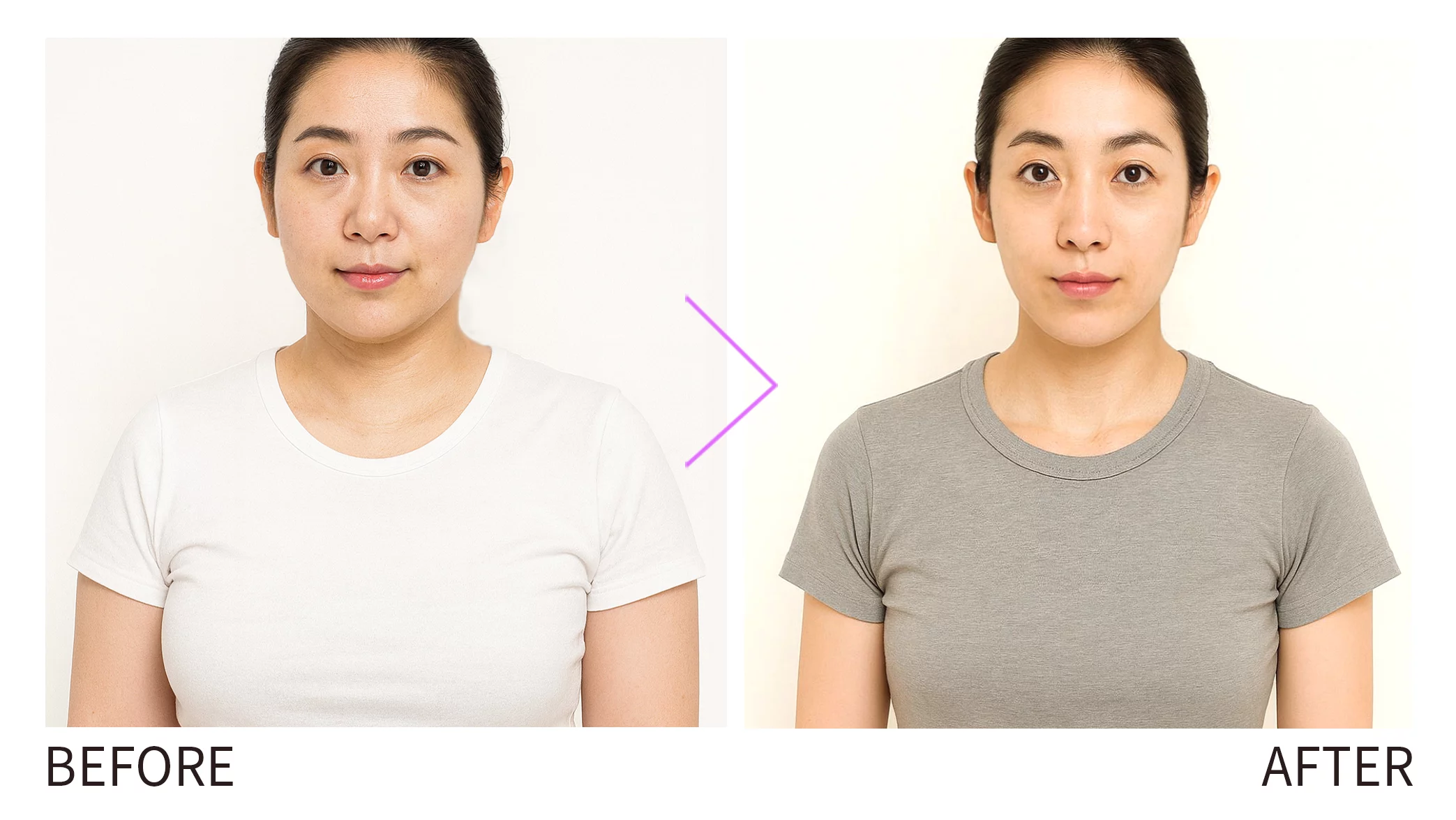 09 晶鑽診所 猛健樂BA 想減重卻總是復胖？猛健樂瘦瘦筆透過 GIP+GLP-1 雙效作用，幫助提升飽足感、降低食慾，臨床實證可達 22.5% 減重效果，更能改善血糖、血脂與內臟脂肪。搭配晶鑽診所專業評估與個人化療程，安全性高、效果持久，讓你不只瘦得快，更瘦得健康。