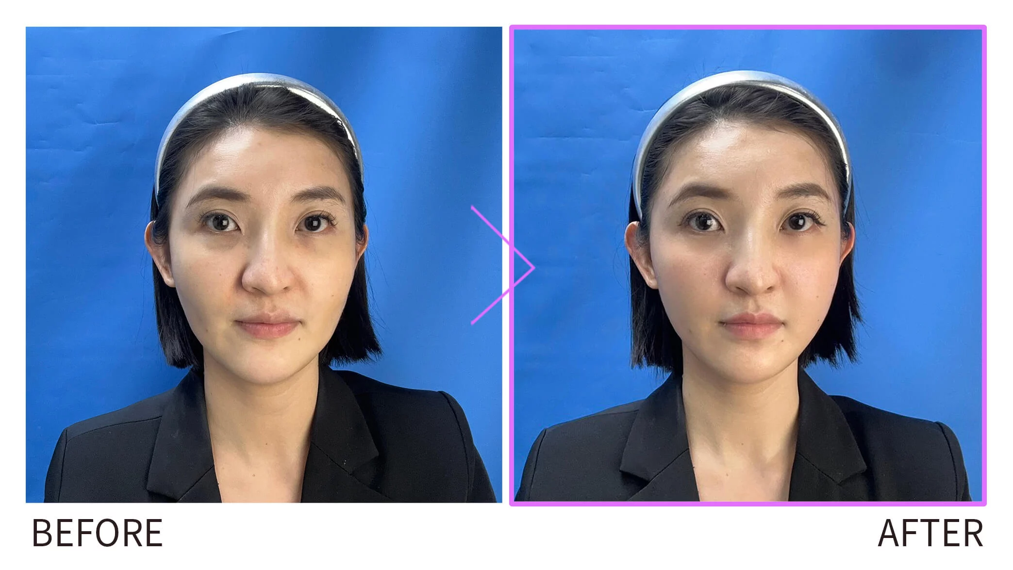 妮芙蕾BA圖 見證人001